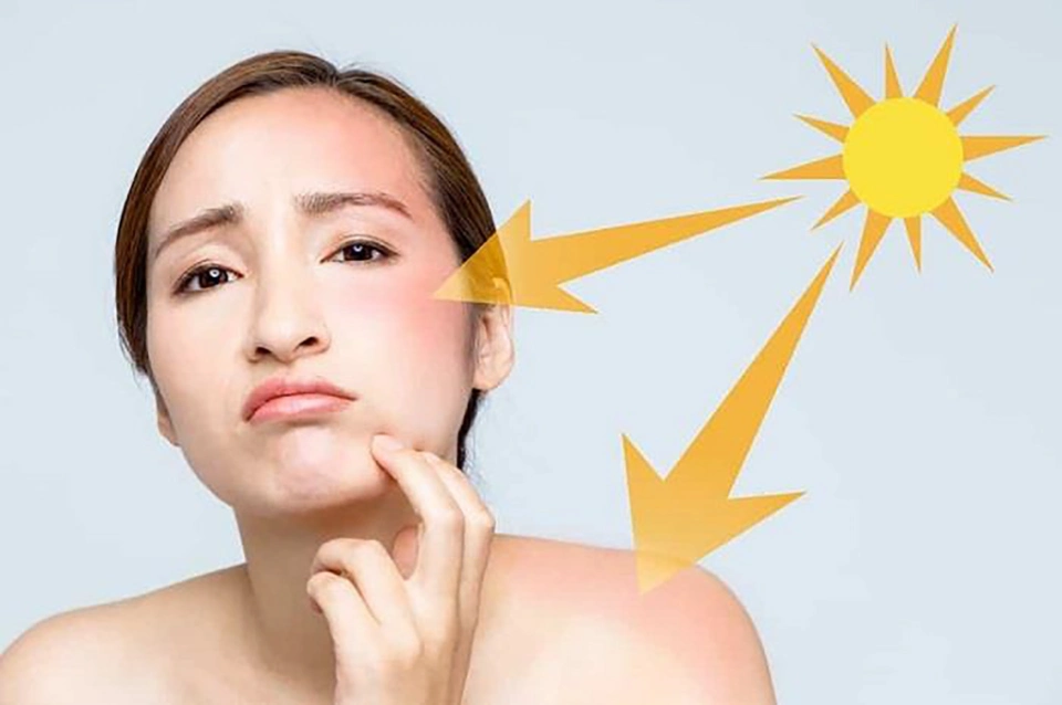 Ảnh bài viết Cách chăm sóc da mặt vào mùa hè hiệu quả, da đẹp rạng ngời