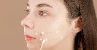 Miếng Dán Mụn Hay Gel Chấm Mụn? Nhìn Nốt Mụn Vài Giây Là Biết Nên Dùng Cái Nào