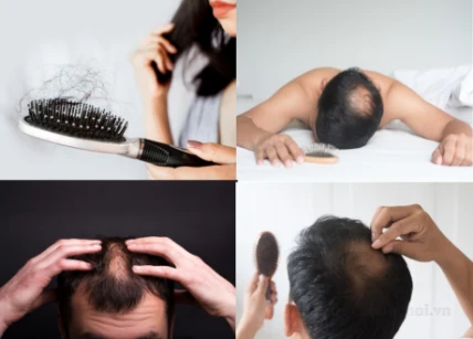 Tinh chất kích mọc tóc Anyanang Herb With Vitamin Hair Treatment Thái Lan ảnh 6