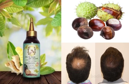 Tinh chất kích mọc tóc Anyanang Herb With Vitamin Hair Treatment Thái Lan ảnh 8