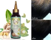 Ảnh sản phẩm Tinh chất kích mọc tóc, hói đầu Anyanang Herb With Vitamin Hair Treatment Thái Lan 2