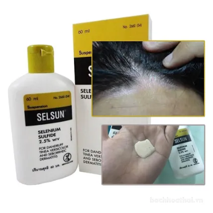 Dầu gội trị gàu, nấm, lang ben Selsun Selenium Sulfide 2.5% ảnh 6