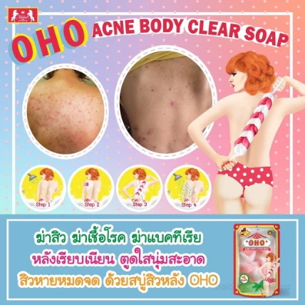 Xà phòng dành cho da mụn OHO Acne Body Clear Soap ảnh 3