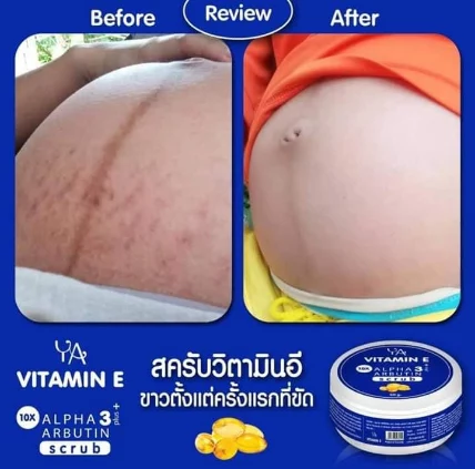 Tẩy tế bào chết Ya VITAMIN E Alpha Arbutin 3 Plus Scrub ảnh 8