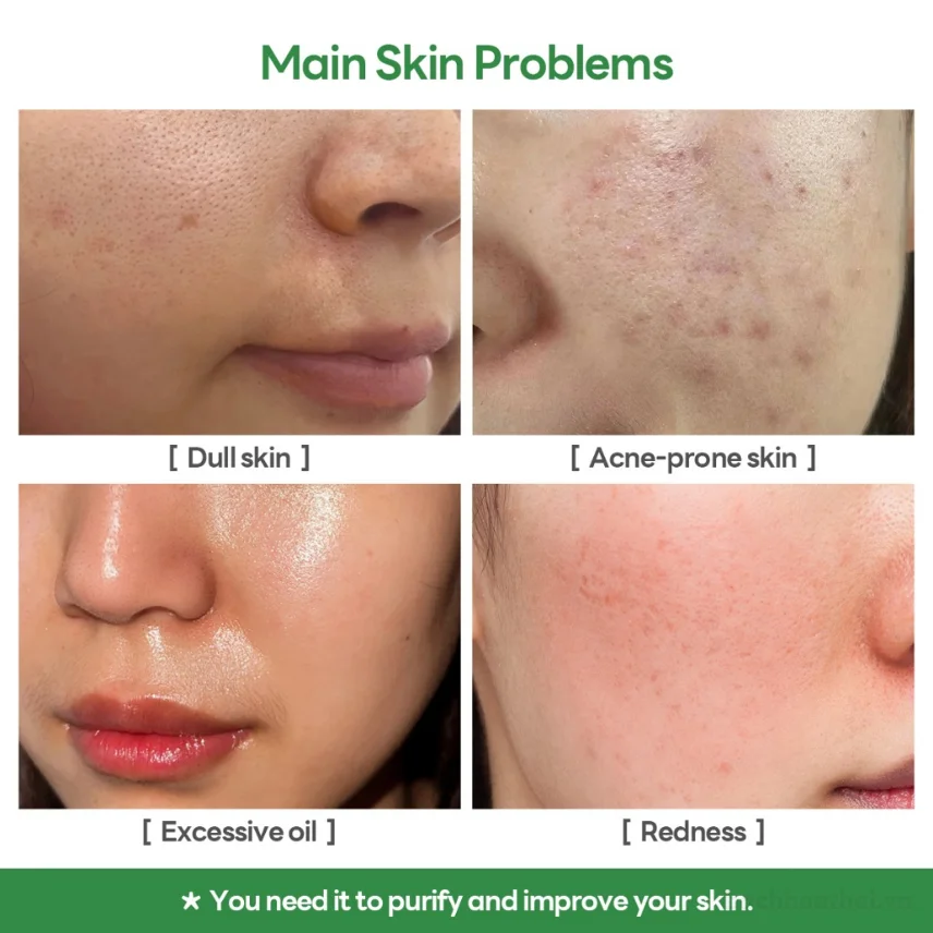 Mặt nạ đất sét làm sạch sâu Papa Feel Alaska Volcano Deep Cleansing Clay Mask ảnh 8