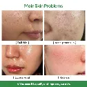 Mặt nạ đất sét làm sạch sâu Papa Feel Alaska Volcano Deep Cleansing Clay Mask ảnh 8