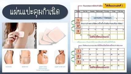 Miếng dán tránh thai Evra Transdermal Patch Thái Lan ảnh 2