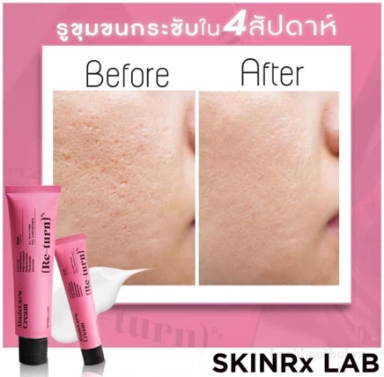 Kem trị sẹo mụn mờ thâm nám tàn nhang dưỡng da mặt SINRx LAB MadeCera Re-turn Cream Thái Lan ảnh 13