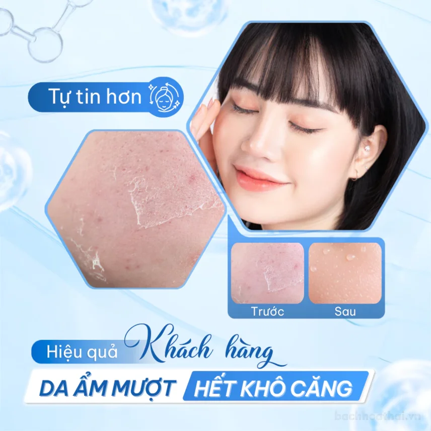 Xịt Khoáng Compliment Aqua Spray 99% cấp ẩm 200mL ảnh 2