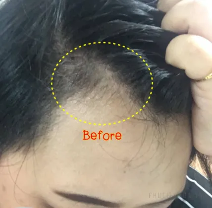 Bút phủ che khuyết điểm da đầu Obuse Contour Liner Thái Lan ảnh 8