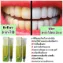 Kem đánh răng thảo dược làm trắng ngăn ngừa các vấn đề răng miệng Botaya Herb Natural Toothpaste  ảnh 5