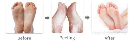Mặt nạ bàn chân Foot peeling mask + Q10 Thái Lan ảnh 8
