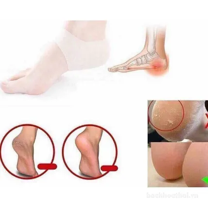 Miếng đệm gót chân silicon giảm đau chữa lành nứt nẻ khô da Healthy Foot ảnh 15