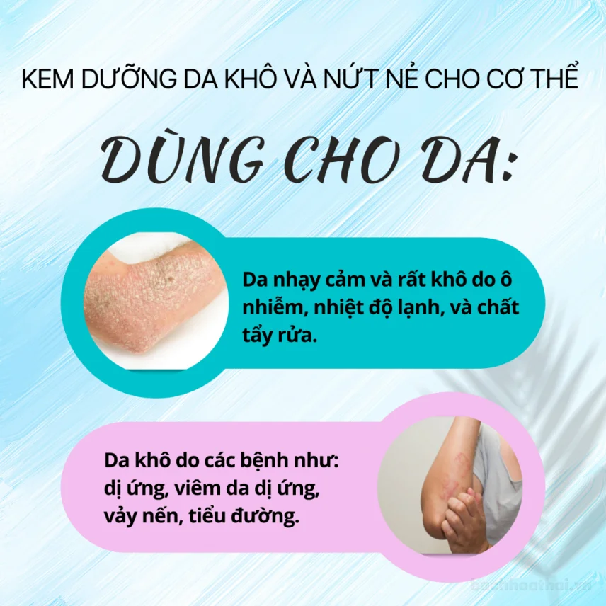 Kem cấp ẩm dành cho da khô, vảy, bong tróc Philosoft Moist Extra Hydrating Cream ảnh 6