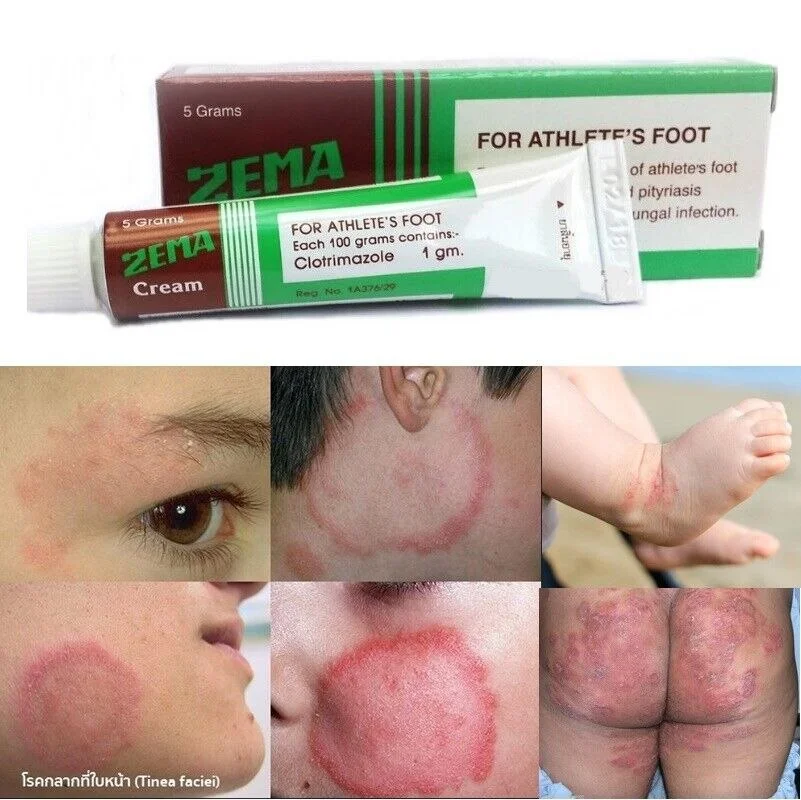 Kem và lotion Zema Thái Lan