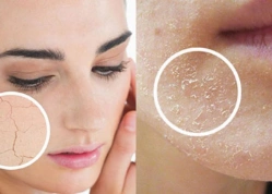 Bật mí 5 cách thoa kem chống nắng trước khi trang điểm hiệu quả