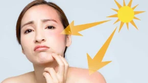 Áp dụng ngay 8 mẹo trị cháy nắng tại nhà, da dịu mát tức thì!