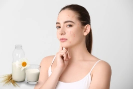 Chuyên gia giải đáp: Sữa có gây ra mụn trứng cá không?