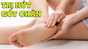 Nứt gót chân phải làm sao? 5 mẹo trị nứt gót chân hiệu quả tại nhà