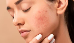 Cách thử dị ứng kem dưỡng da & dấu hiệu nhận biết cực chuẩn!