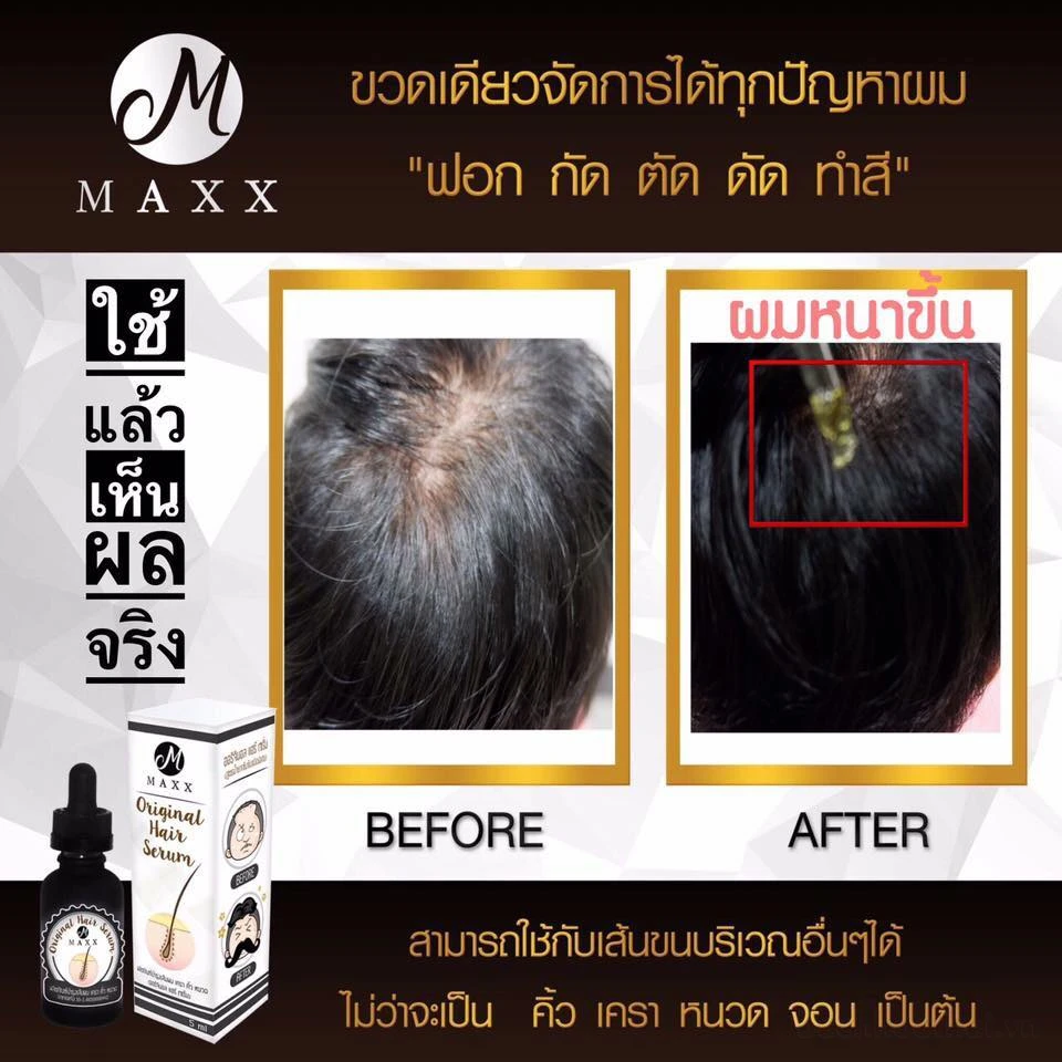 Serum kích mọc tóc, râu Maxx Original Hair