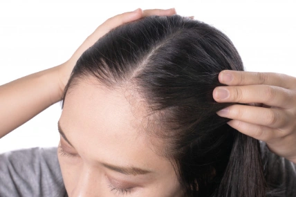 Dầu gội ngăn ngừa rụng tóc Bergamot Extra Delicate Shampoo Thái Lan ảnh 7