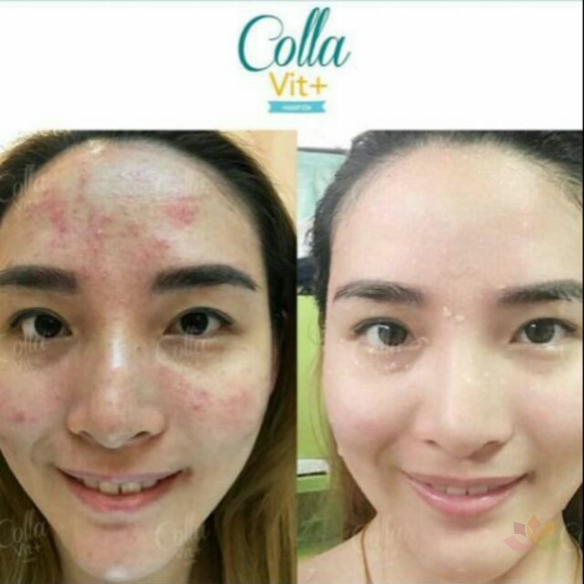 Viên uống trắng da Colla Vit C Plus ảnh 5