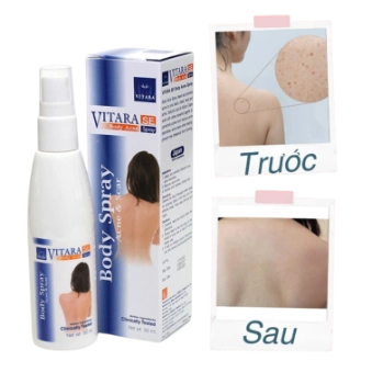 Ảnh sản phẩm Chai xịt trị mụn lưng VITARA SE Body Acne Spray 1