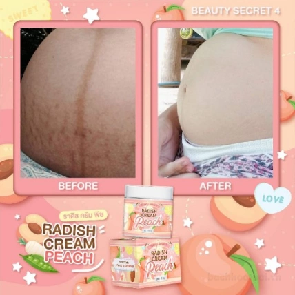 Kem trị thâm rạn mờ sẹo dưỡng trắng da Beauty Secret 4 Radish Cream Peach ảnh 13