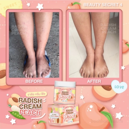 Kem trị thâm rạn mờ sẹo dưỡng trắng da Beauty Secret 4 Radish Cream Peach ảnh 14