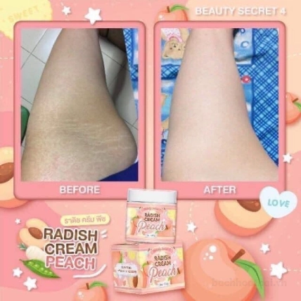 Kem trị thâm rạn mờ sẹo dưỡng trắng da Beauty Secret 4 Radish Cream Peach ảnh 11