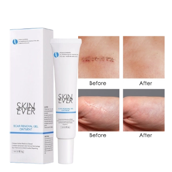 Ảnh sản phẩm Gel cải thiện Sẹo SKIN EVER Scar Removal Gel Ointment chiết xuất thảo dược phục hồi da  1