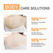Ảnh sản phẩm Sữa dưỡng thể sáng da giảm mụn cơ thể SKINEVER Salicylic Acid Weightless Exfoliating Body Lotion 
 2