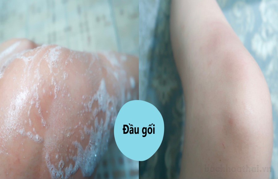 tẩy tế bào chết
