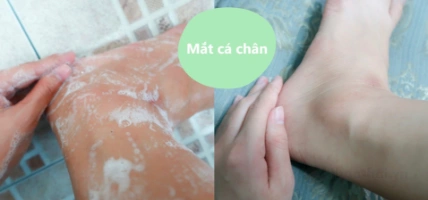 Xà phòng tắm tẩy tế bào chết toàn thân Ura Butt Gluta Collagen Scrub soap ảnh 17