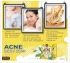 Xà phòng trị mụn trắng da toàn thân Beauty 4 Secret Acne Body Soap ảnh 15