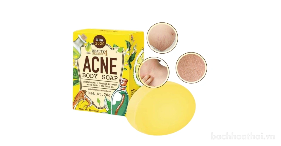 Xà phòng trị mụn trắng da toàn thân Beauty 4 Secret Acne Body Soap