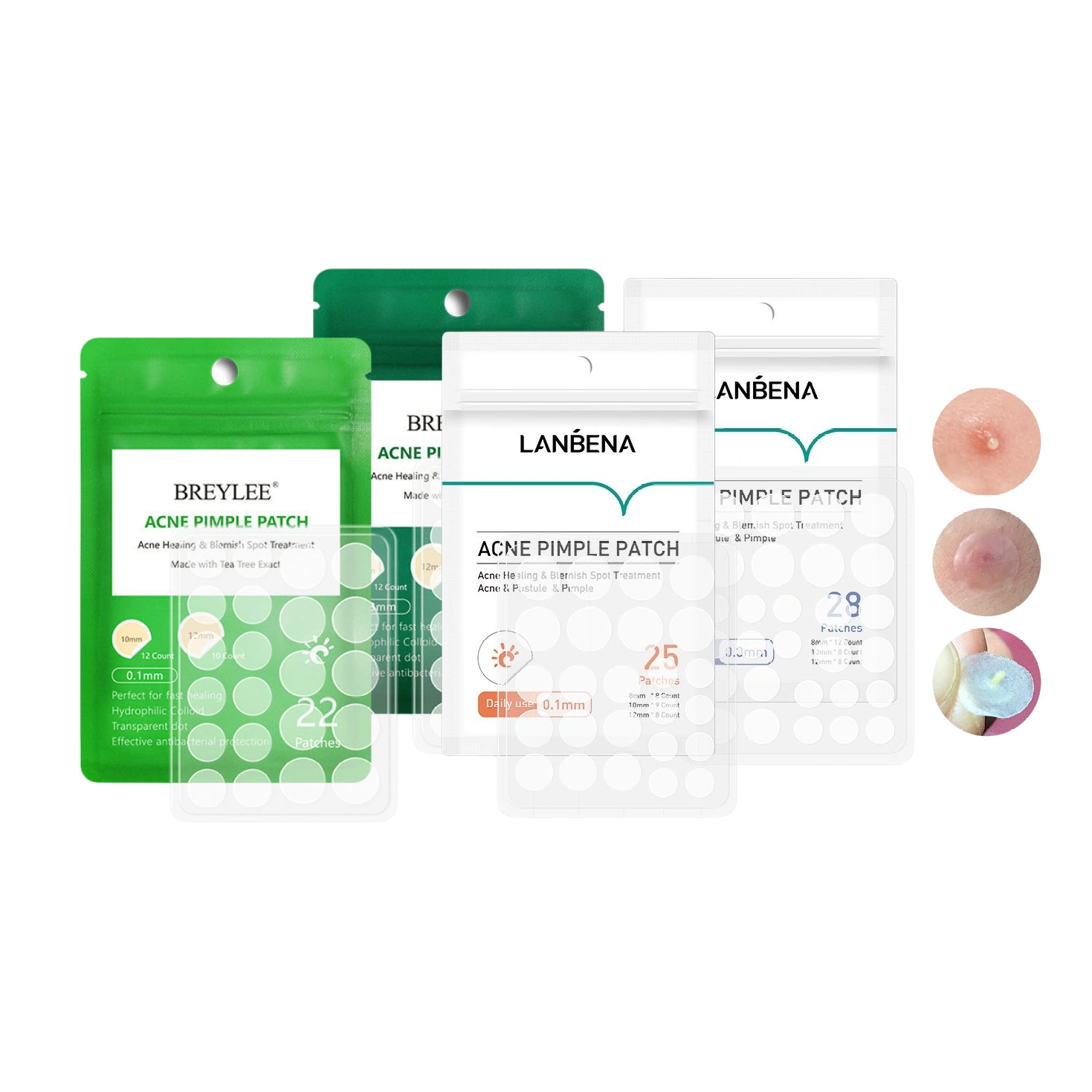 Miếng dán mụn Lanbena Breylee Acne Pimple Patch
