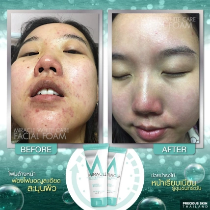 Sữa rửa mặt Miracle White Care Facial Foam Thái Lan ảnh 5