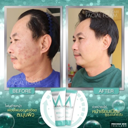 Sữa rửa mặt Miracle White Care Facial Foam Thái Lan ảnh 6