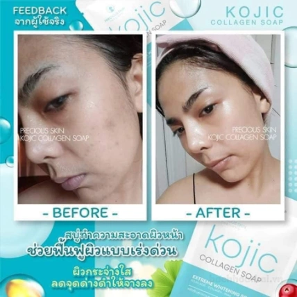 Xà phòng rửa mặt trắng da Kojic Collagen Soap ảnh 9