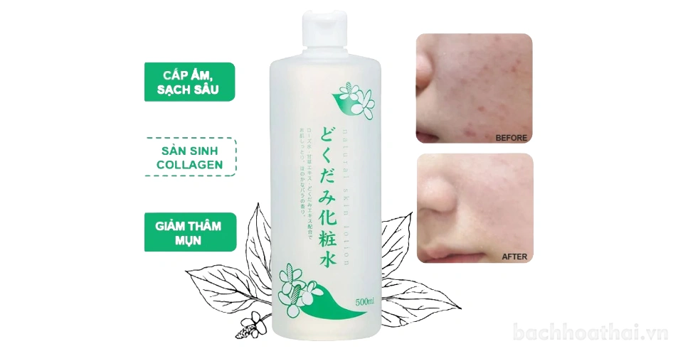 Nước hoa hồng diếp cá Dokudami Natural Skin Lotion Nhật Bản