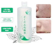 Ảnh sản phẩm Nước hoa hồng diếp cá Dokudami Natural Skin Lotion Nhật Bản 1