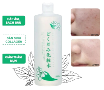 Nước hoa hồng diếp cá Dokudami Natural Skin Lotion Nhật Bản