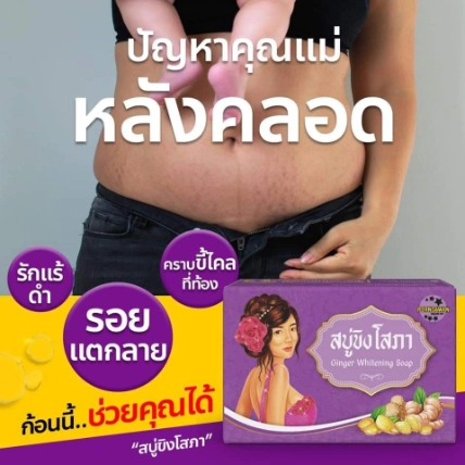 Xà phòng gừng rửa mặt trắng da ngừa mụn Ginger Whitening Soap ảnh 9