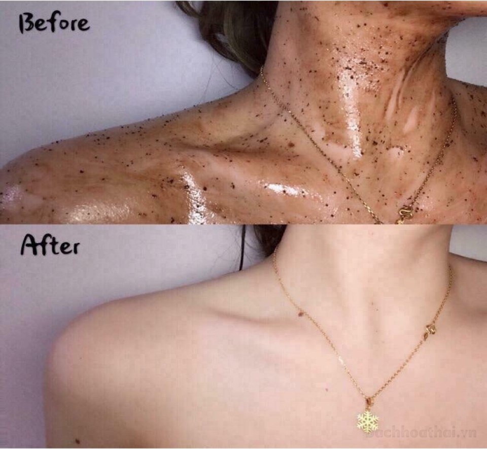 tẩy tế bào chết