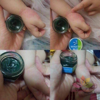 Dầu bôi trị muỗi đốt Yanhee Green Balm Mosquito Brand ảnh 3