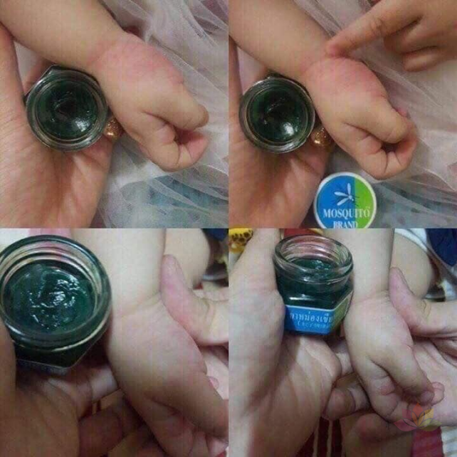 Dầu bôi trị muỗi đốt Yanhee Green Balm Mosquito Brand ảnh 3