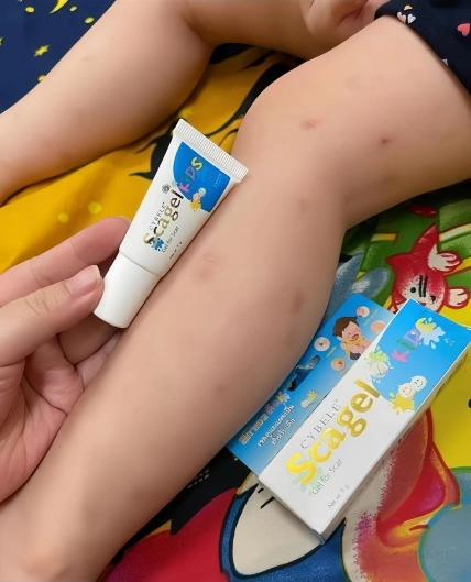 Gel bôi sẹo thâm, côn trùng cắn dán cho bé Cybele Scagel Kids 9gr ảnh 3