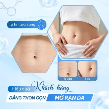 Ảnh sản phẩm Serum dưỡng thể làm ấm thon gọn Eveline Slim EXTRENE 4D 2
